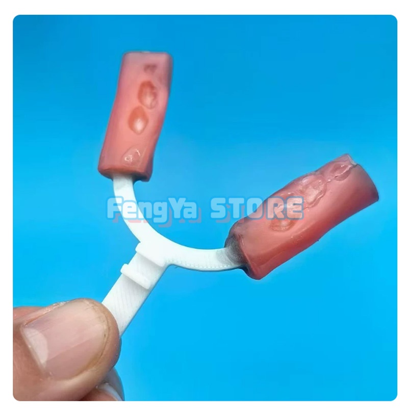 10Pcs/Bag Orthodontic Mandibul - đánh giá và giá 3D Printing Orthodontics