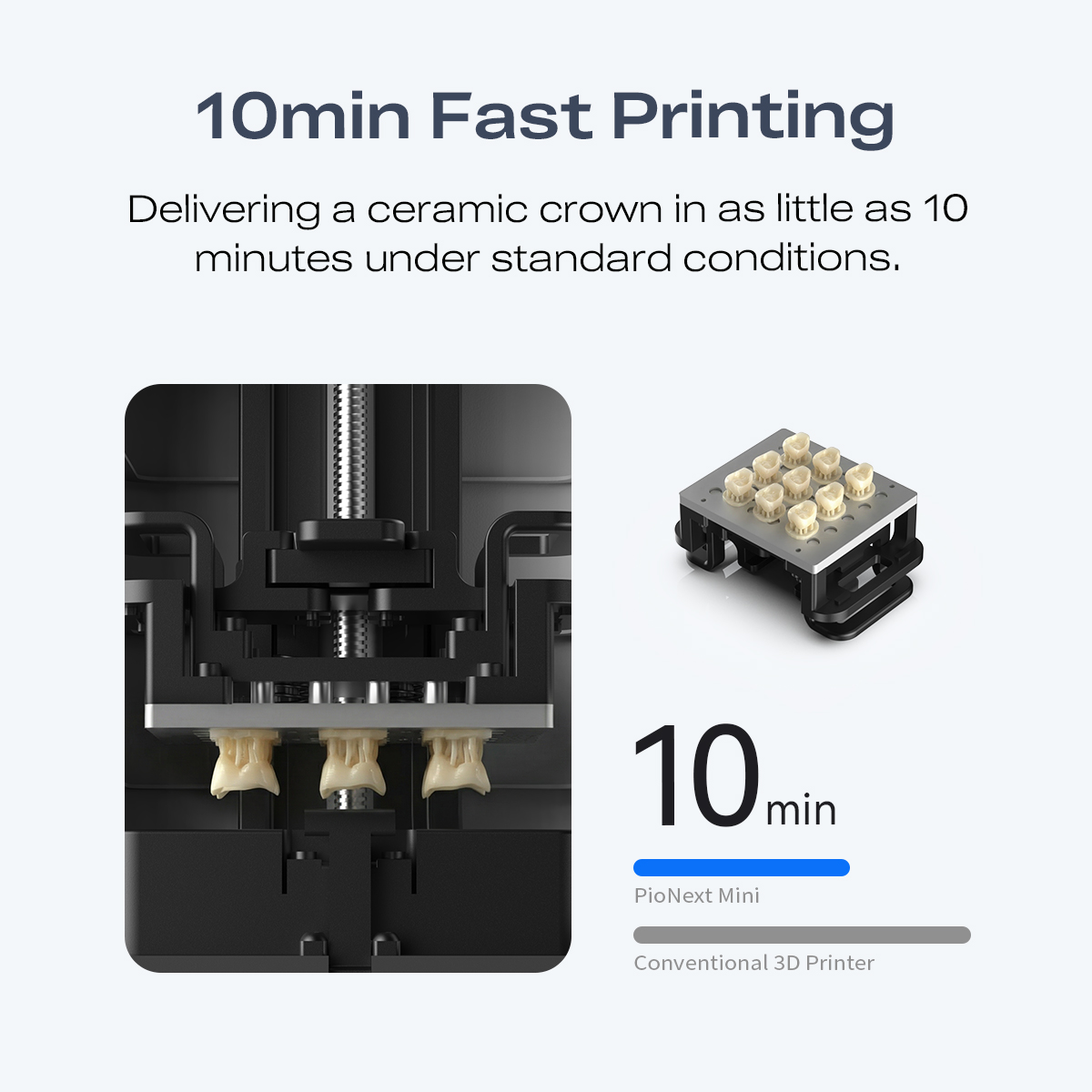 Mini High-precision Dental 3d  - đánh giá và giá 3D Printing Orthodontics