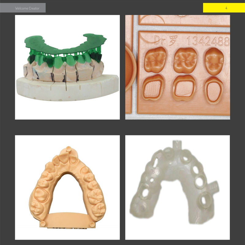 Resin 3D Printer Dental Castin - đánh giá và giá 3D Printing Orthodontics