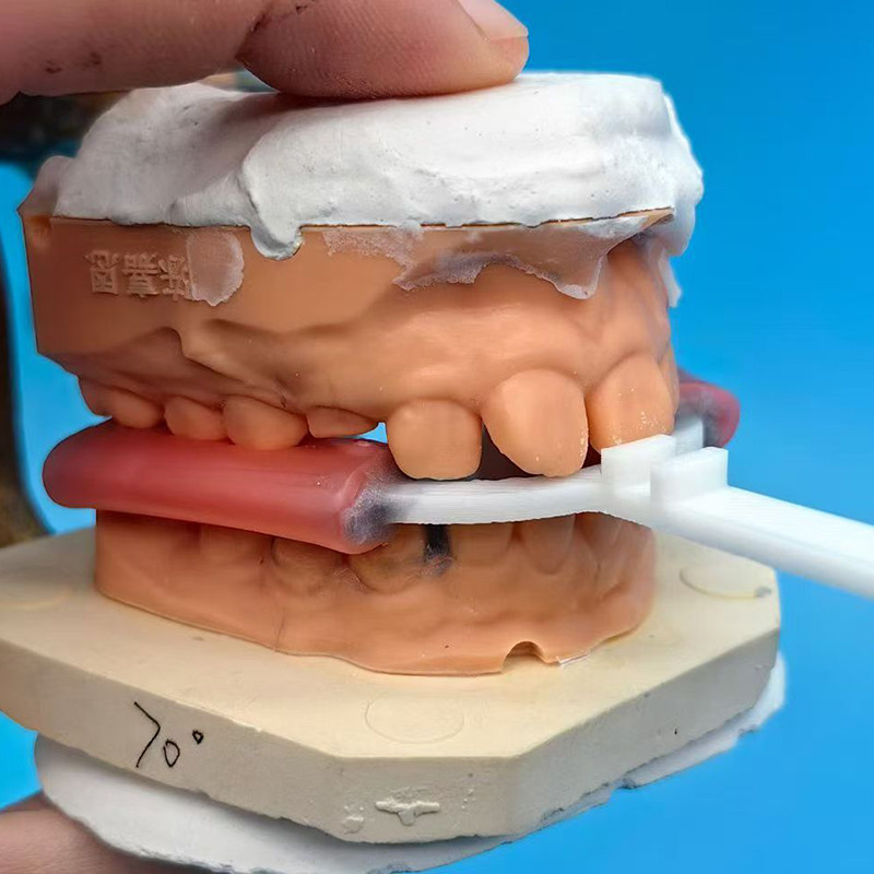 10Pcs/Bag Dental Bite Fork Ort - đánh giá và giá 3D Printing Orthodontics
