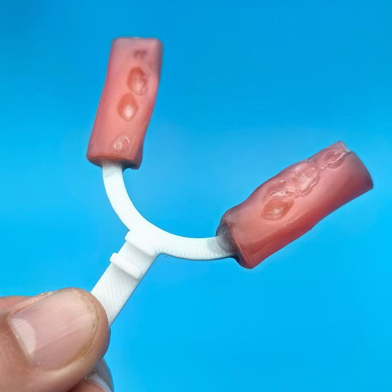 10Pcs/Bag Dental Bite Fork Ort - đánh giá và giá 3D Printing Orthodontics