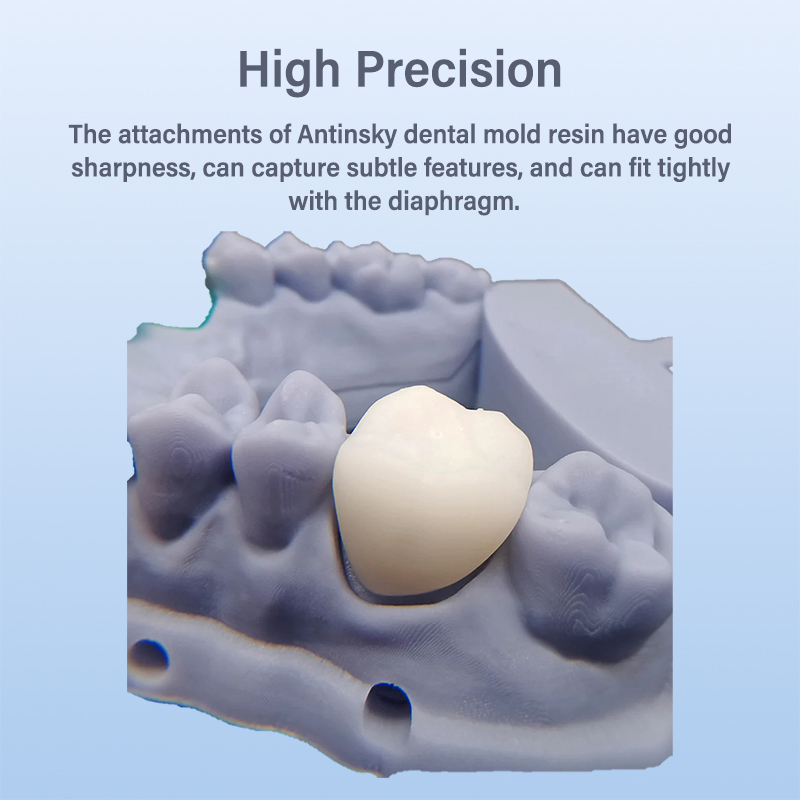 Antinsky Temporary Dental Mode - đánh giá và giá 3D Printing Orthodontics
